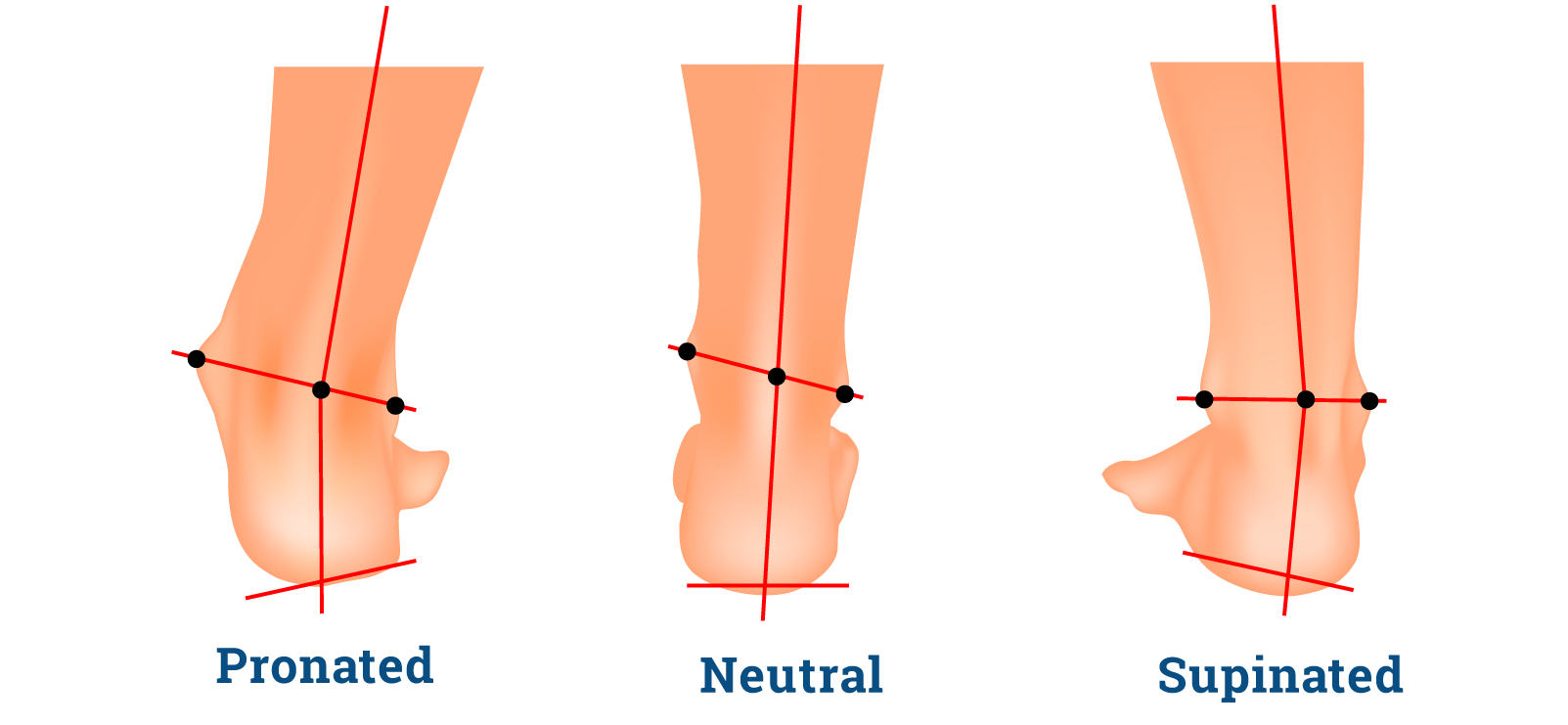 arch feet meaning