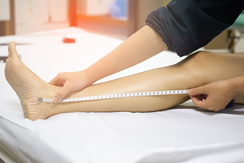 Limb Lengthening Surgery Is Becoming More Popular