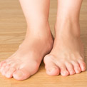 What are Bunions?