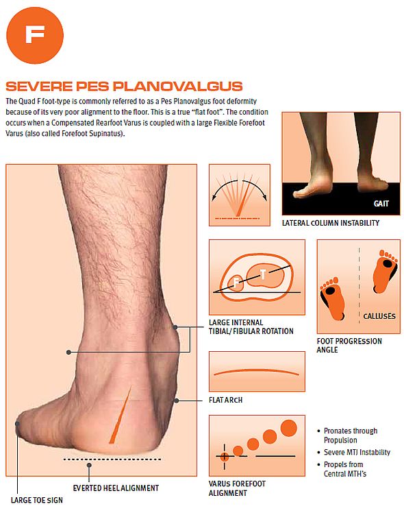 flat foot inner soles