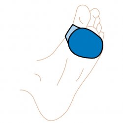 Silipos Slim Gel-Fit Metatarsal Ball of Foot Pad